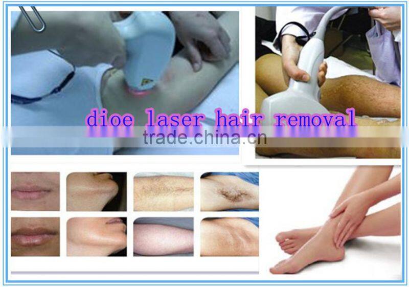 pain free 808 diode laser hair removal machine