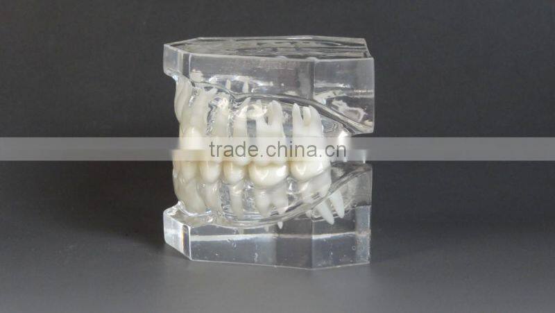 Malocclusion Classification Demonstration Model 1