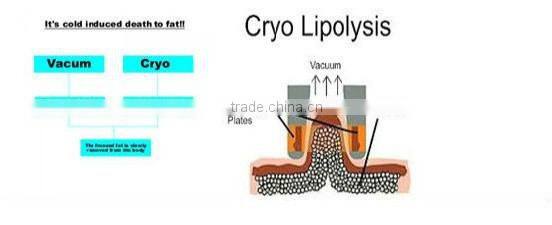 4 finctions in one mode 5 handles double chin fat reduction machine for sale