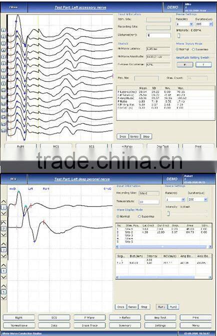 2015 CE&ISO Approved EMG EP Systems Electromyography myoelectricity Measuring System for Neurology
