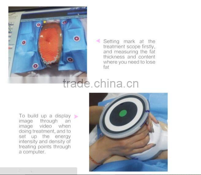 beauty slimming machine ultrashape 2015