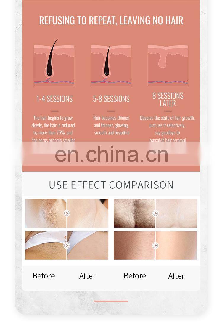 New product 2 in 1 808nm diode laser picosecond laser for hair removal tattoo removal carbon laser