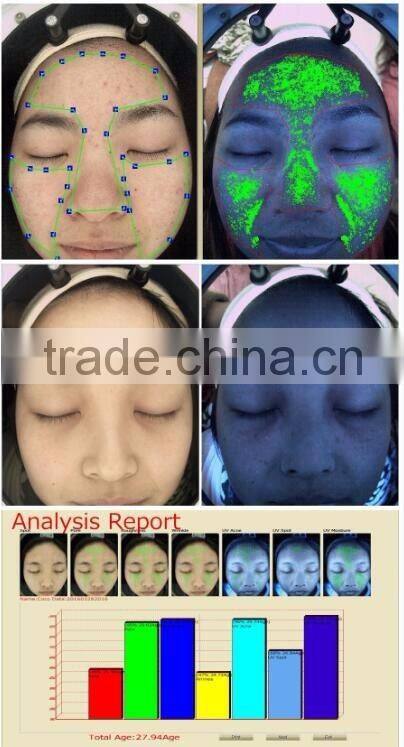 High Quality Low Price Professional Skin Analyzer Machine