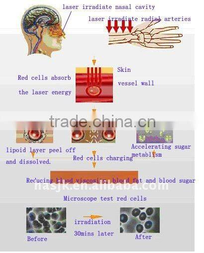 Improving Oxygen Carrying CE Approved Physical Therapy Cold Laser Medical Equipment