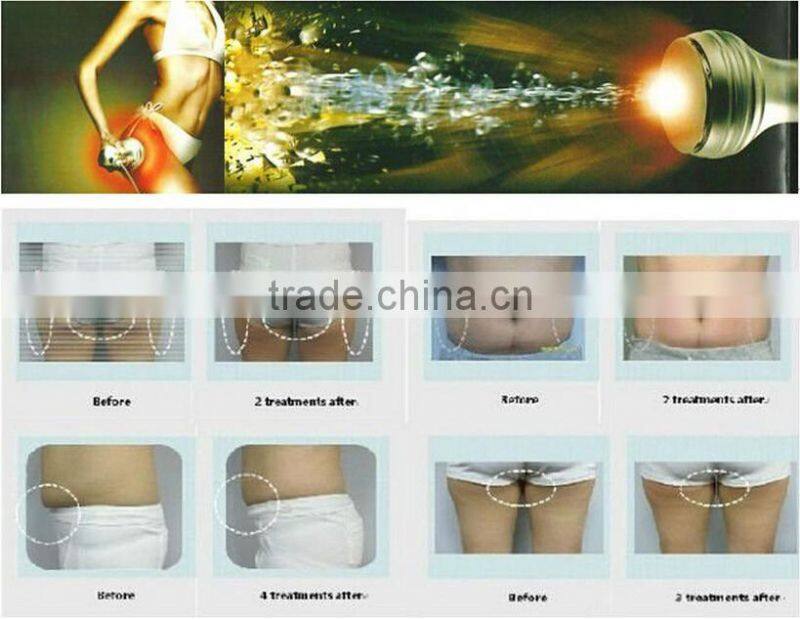 AYJ-827B(CE)Beauty Portable Desktop cavitation slimming machine/Cavitation RF Weight Loss