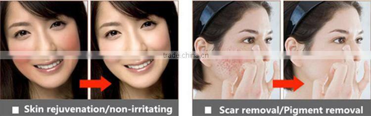 The popular home mini RFphoton led skin rejuvenation device led light treatment for face whitenning