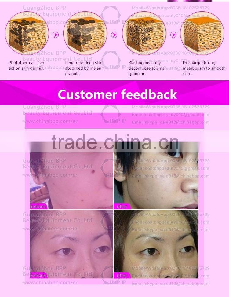 Best quality and lowest price for freckle removel laser pen