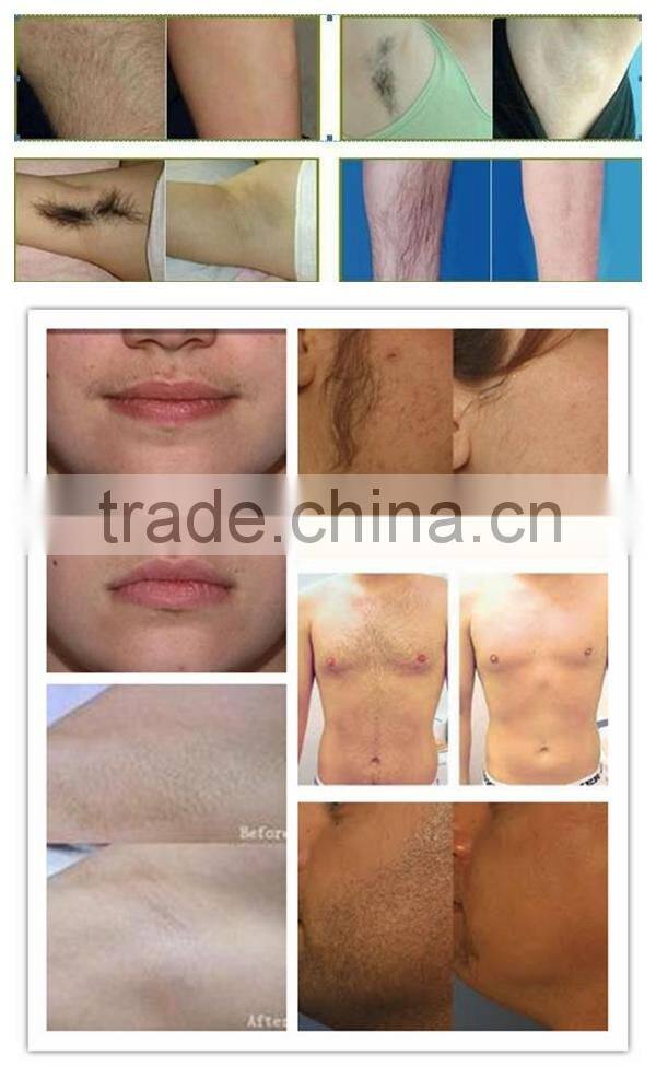 Manufacturers Looking For Distributors / 2015 Hot Vertical 808nm Diode Laser Hair Removal Beauty Salon Equipment