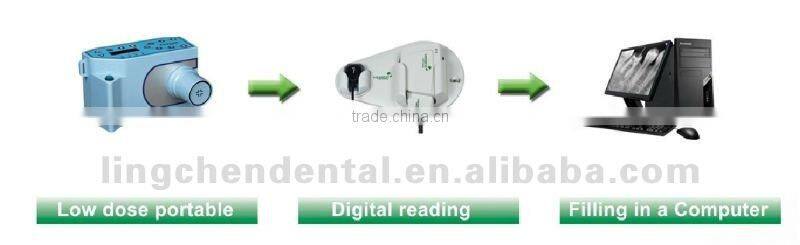 Dental Digital Wireless x-ray machines