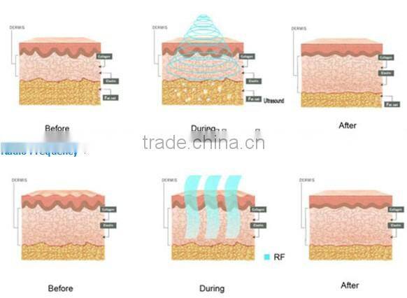 latest chinese product 6 in 1 Portable Multifunctional Beauty Machine/slimming machine/cosmetic apparatus