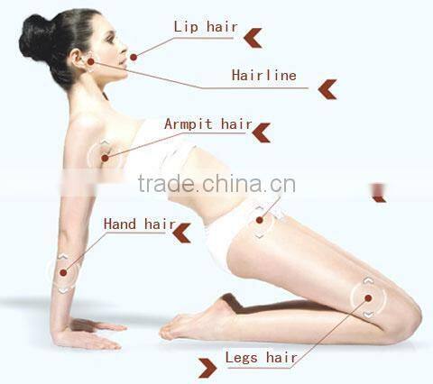 High quality and low price! Professional diode laser/808nm diode laser/laser hair removal for permanent hair removal
