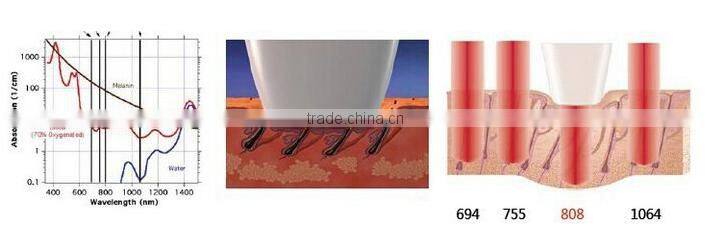 Factory price high quality 808nm Diode Laser Hair Removal beauty equipment&machine