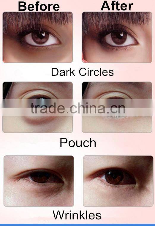 hot in 2016 factory price eye beauty popular vibration eye max massager