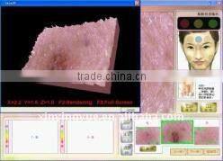 the New Particular for Hair and skin analyzer