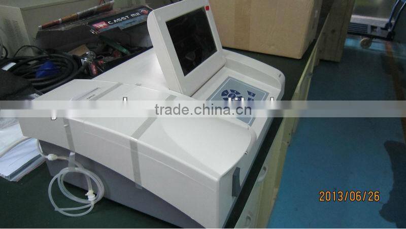 YSTE168 hot sale Built-in thermal printer semi-auto biochemistry analyzer for sale
