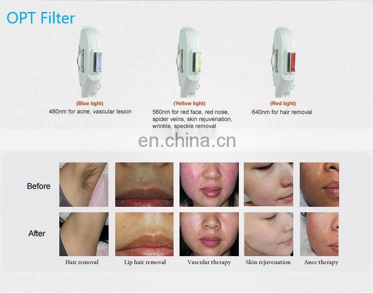 2019 New Style Portable hair removal OPT IPL SHR laser fast hair removal+elight+ RF +laser Machine