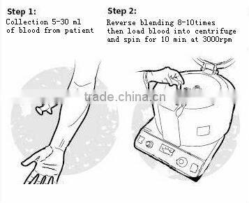 facial use blood collecting tube( PRP tube)