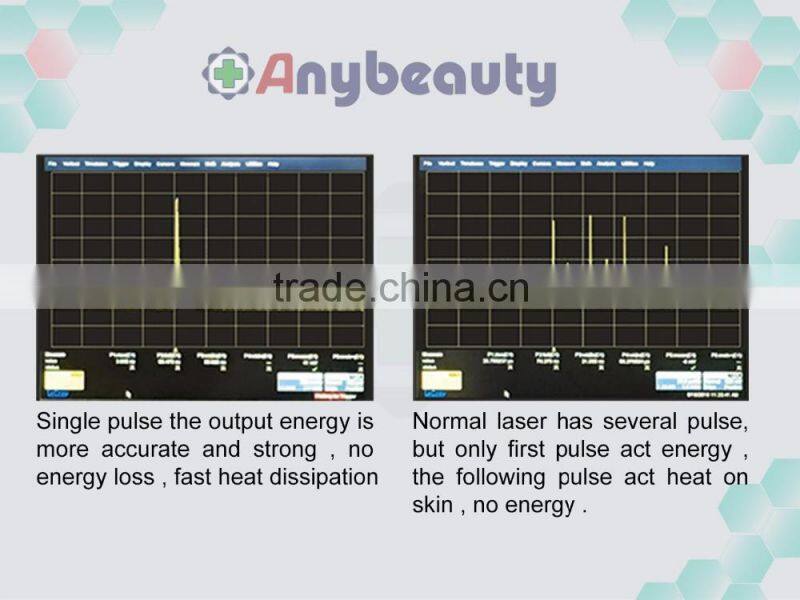 ZFL-B Laser picosure tattoo removal machine q switch nd yag laser 1064 nm 532nm nd yag laser