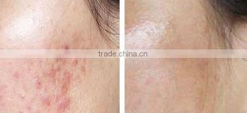 Handheld Massage Roller/Facial Beauty Roller L007