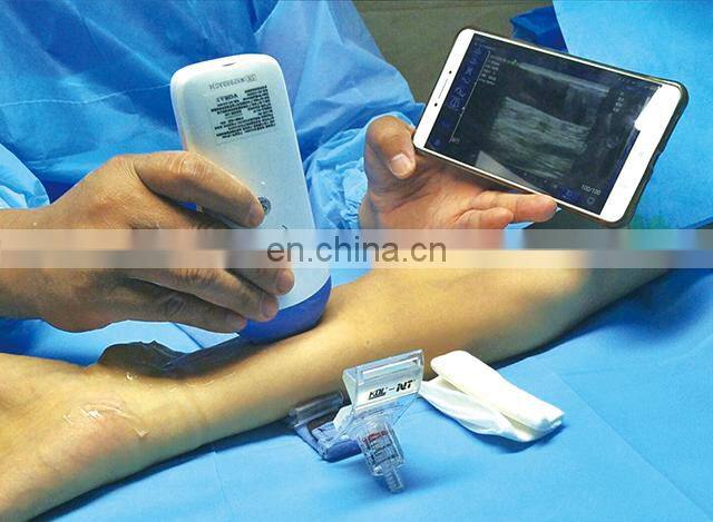 Sales 2022 factory price portable wireless ultrasound scanner ultrasound machine