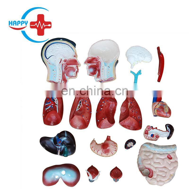 HC-S239 Hot Sale Medical Science Male Trunk Model/Male Model 85CM Male Torso Model with 19 pieces