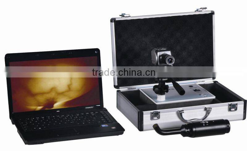 Professional Infrared Mammary Gland Inspection Equipment for mammary diseases