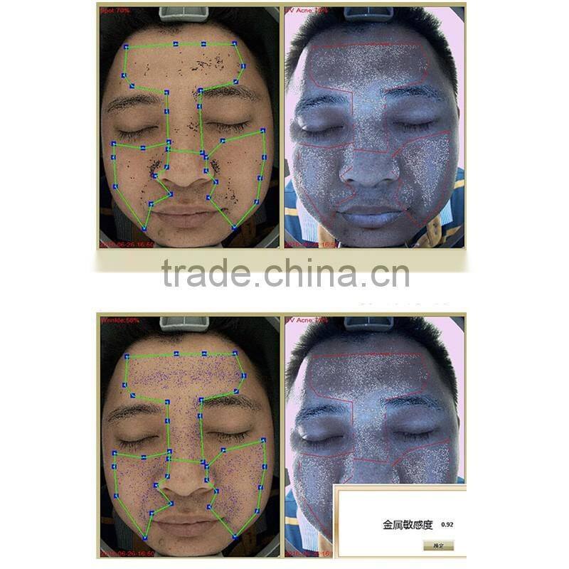 new technology face skin test machine/skin analysis machine
