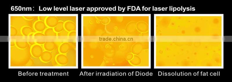 Lipolysis Slimming Machine Lipo Laser Beauty Equipments