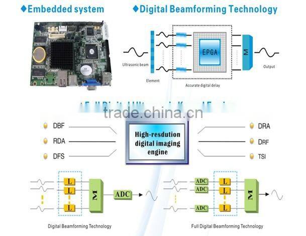 2016 new veterinary laptop ultraaouns machine with 3D function