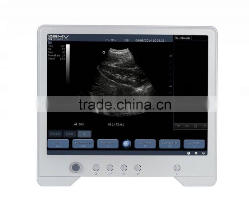 B Mode Portable Ultrasound Price TS20