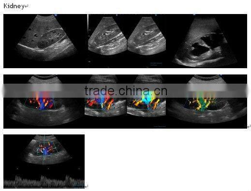 3D and 4D Color Doppler with 4D Real Time Live Probe iSpark 480plus/option Trans-vaginal Array Probe (180)