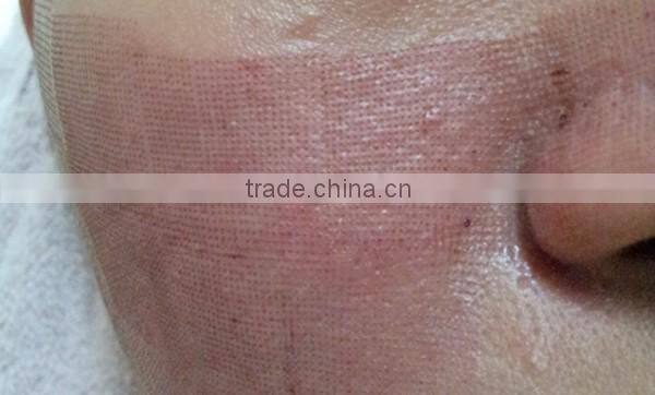 Professional CO2 Fractional Laser Machine For Women Skin Resurfacing POP IPL FC10