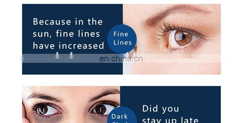 2019 High quality eye relaxing massage microcurrent red light heated eye massager pen