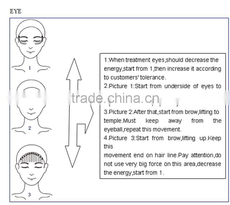 IPL 3in1 tattoo removal laser/new laser for tattoo removal/laser tattoo removal machine factory price