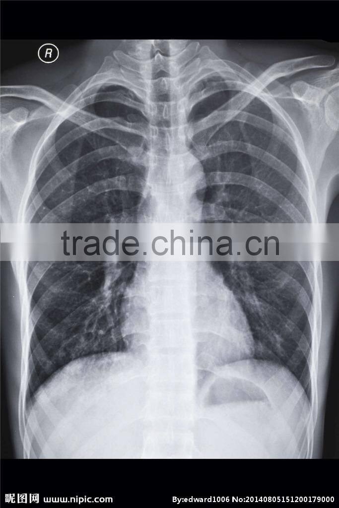 AOMYA FILM INK for Medical x ray film,medical dry film,CT film