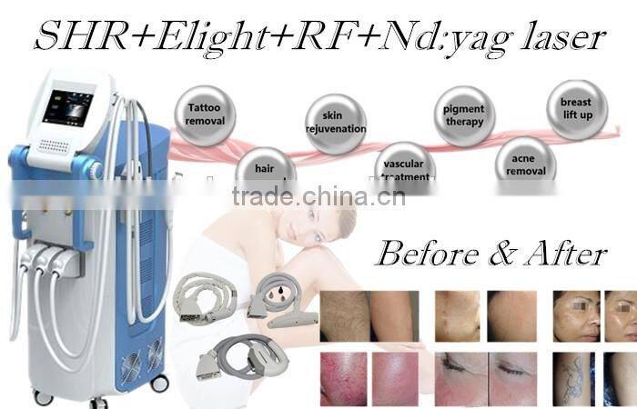 shr opt / opt shr / opt hair removal