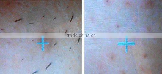 Multi-Fuction Facial Care