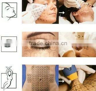 Professional Beauty Equipment China Supplier Low Price Radio Frequency Nano Fractional RF For Skin Tightening & Anti Wrinkle