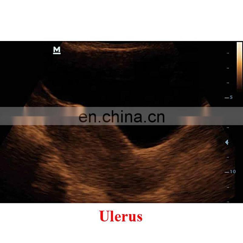 DP-20 Mindray Portable Full Digital Ultrasound Machine Price Mindray Color Ultrasound LED