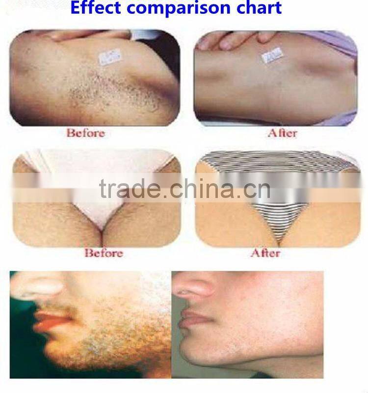 Medical 808nm cavitation weight loss machine Hair Removal Machine