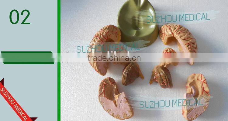 Distribution of brain and cerebral arteries