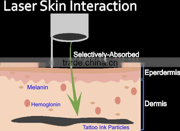 Best tattoos removal 532nm and 1064nm yag laser tip heads