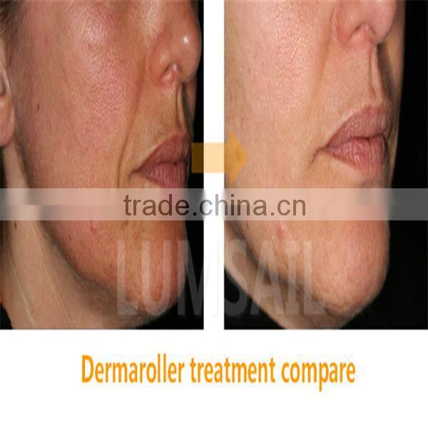 2015 factory direct sale skin care roller micro needle derma roller/derma cosmetic