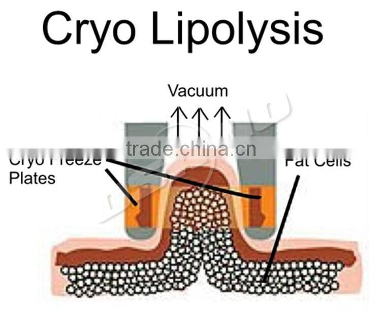 High Quality Coolsculption Cool Shaping Cryolipoly Machine