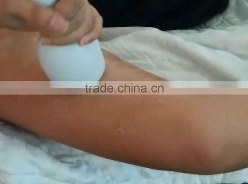 hifu machine for wrinkle removal body slimming