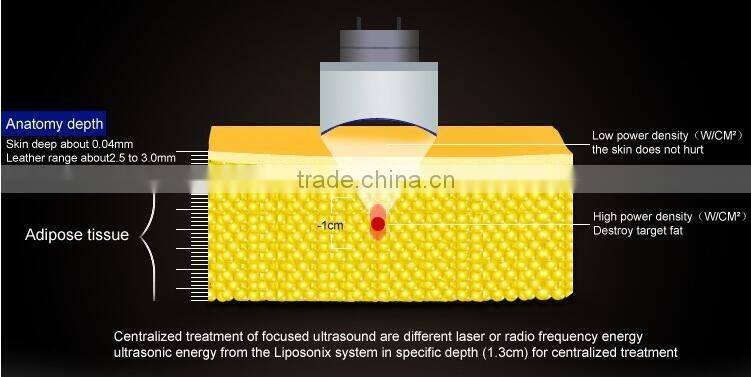 2016 Lipohifu ultrasonic liposuction body slimming machine - JT-Slim1