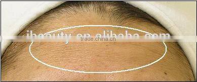 2016 New product MR16-2SB New product microneedle /needle free mesotherapy machine