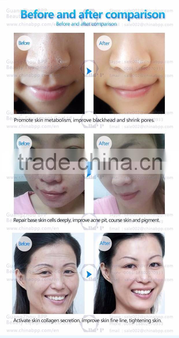 Factory wholesale led facial mask with 3 pdt photon colors 170pcs led lights face mask in stock CE approved