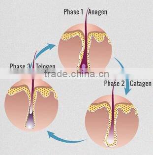 Hottest sale product !!!! professional ipl hair removal machine ipl trolley