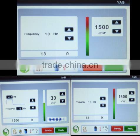 OEM IPL shr hair removal machine Q switched nd yag laser tattoo removal machine